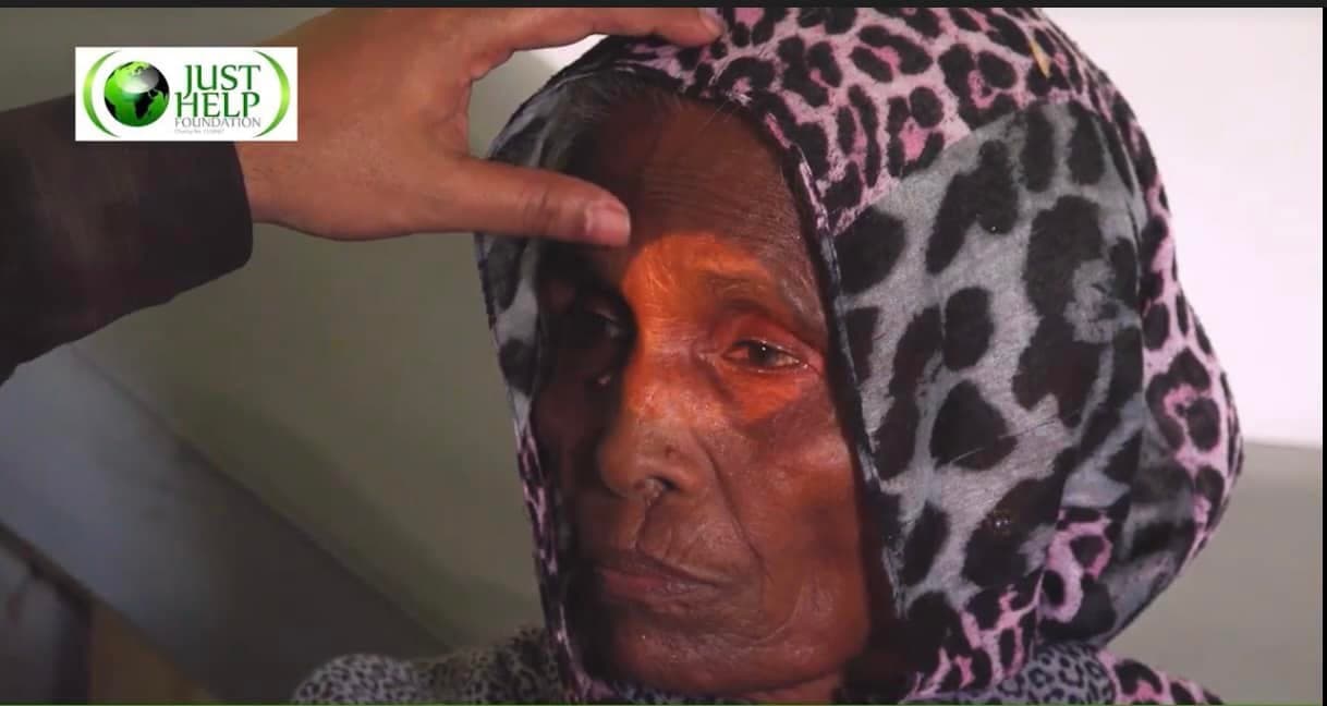 A patient receiving eye treatment at a Just Help Foundation camp